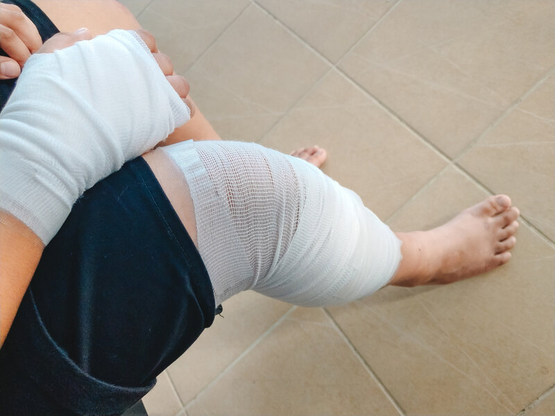 injured hand and knee due to car accident