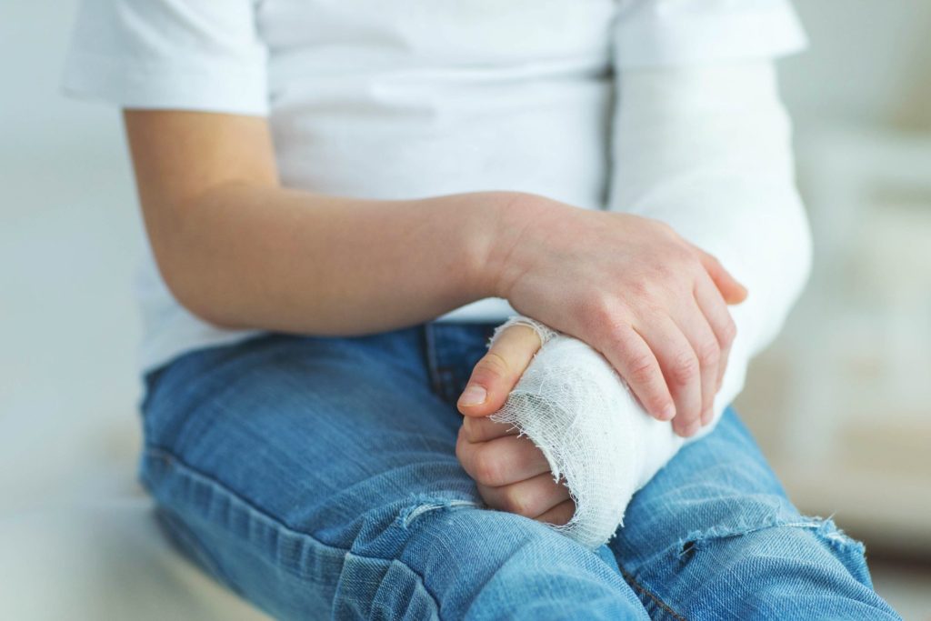child with cast on arm
