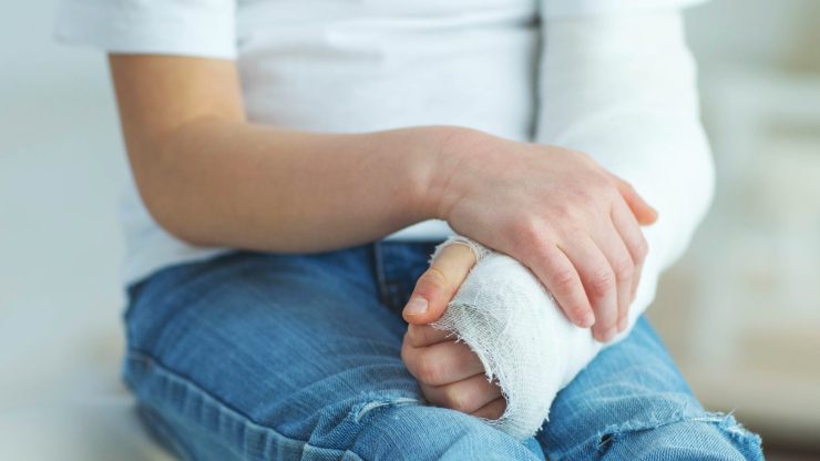 child with cast on arm