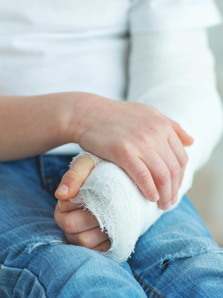 child with cast on arm